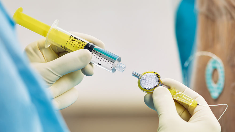 İlaçla doldurulmuş bir şırınga, bölgesel anestezi için özel bir konektöre sahip filtreye bağlanır.